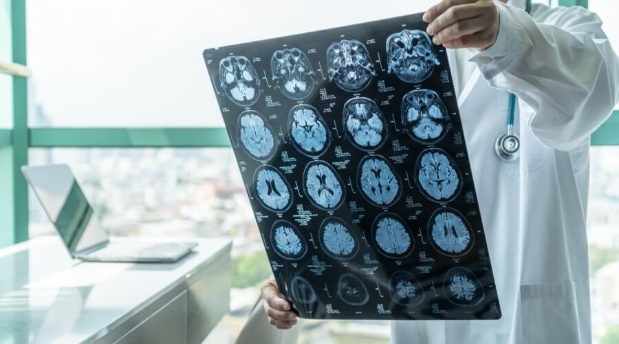 دكتور مخ واعصاب