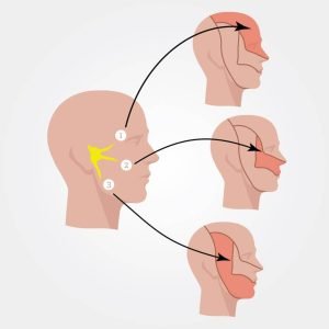 العصب الخامس-دكتور مخ واعصاب مصر الجديدة-دكتور مخ واعصاب-دكتور خالد عبدالمقصود-افضل دكتور مخ واعصاب -العصب الخامس.