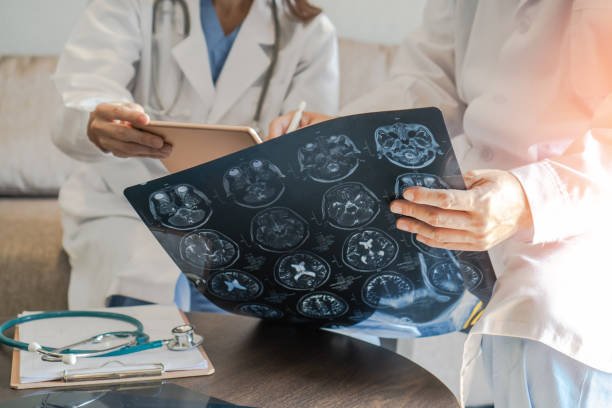 علاج جلطة المخ 4